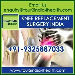 Cost of Knee Replacement Surgery in India Cost of Knee Replacement Surgery in India